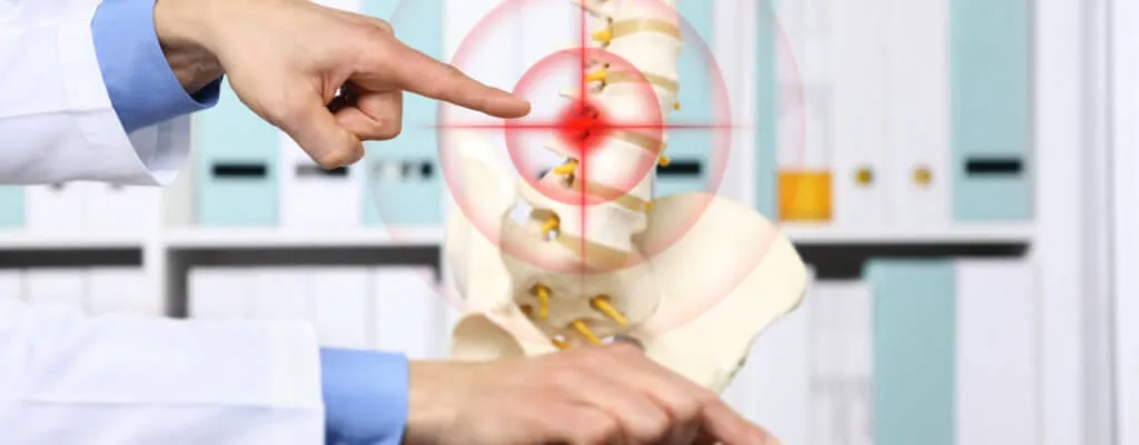 Back Pain is Commonly Caused by Herniated Discs – Do You Know Where Your Pain is Coming From?