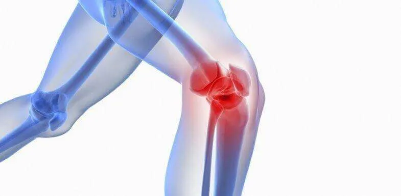 Effortless Ways to Beat Knee Pain While Running